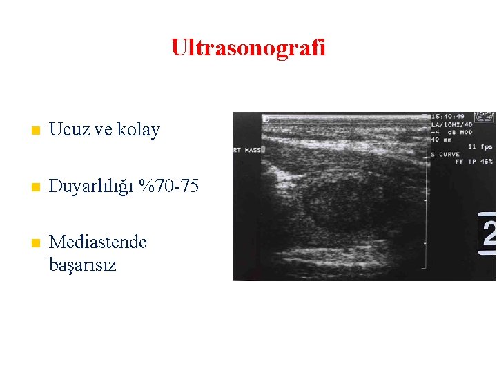 Ultrasonografi Ucuz ve kolay Duyarlılığı %70 -75 Mediastende başarısız 