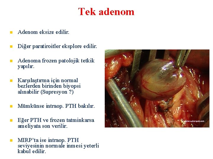 Tek adenom Adenom eksize edilir. Diğer paratiroitler eksplore edilir. Adenoma frozen patolojik tetkik yapılır.