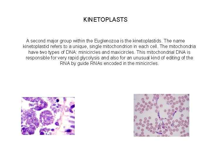 KINETOPLASTS A second major group within the Euglenozoa is the kinetoplastids. The name kinetoplastid