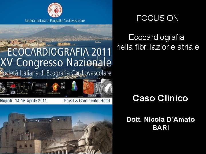 FOCUS ON Ecocardiografia nella fibrillazione atriale Caso Clinico Dott. Nicola D’Amato BARI 