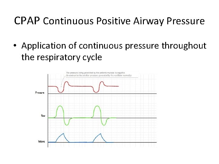 CPAP Continuous Positive Airway Pressure • Application of continuous pressure throughout the respiratory cycle
