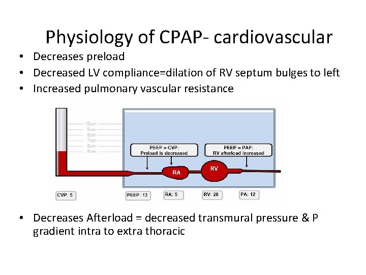 Physiology of CPAP- cardiovascular • Decreases preload • Decreased LV compliance=dilation of RV septum