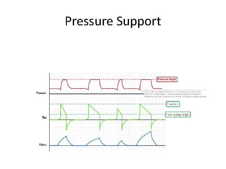 Pressure Support 