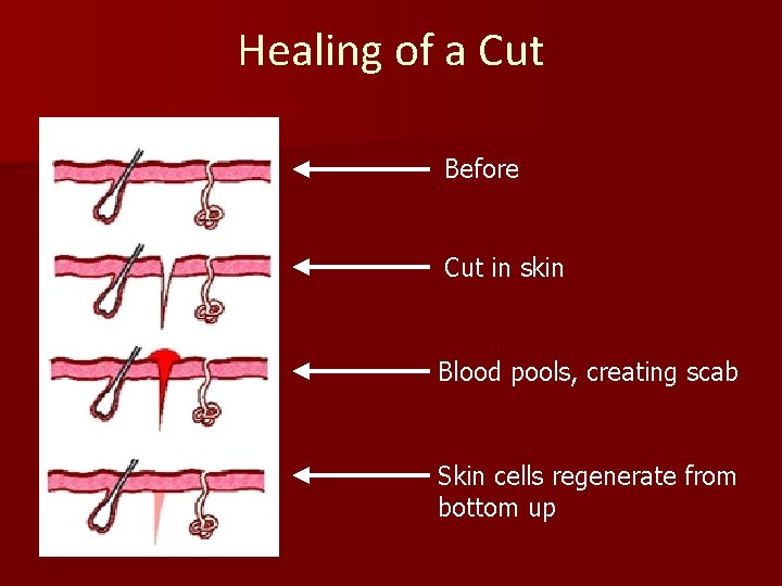 Healing of a Cut Before Cut in skin Blood pools, creating scab Skin cells