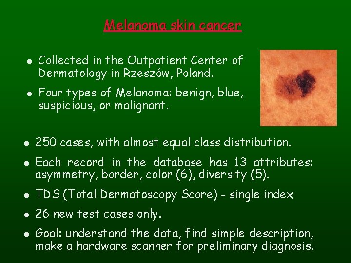 Melanoma skin cancer l l Collected in the Outpatient Center of Dermatology in Rzeszów,