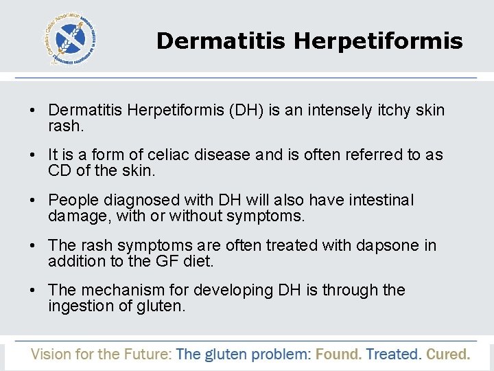 Dermatitis Herpetiformis • Dermatitis Herpetiformis (DH) is an intensely itchy skin rash. • It
