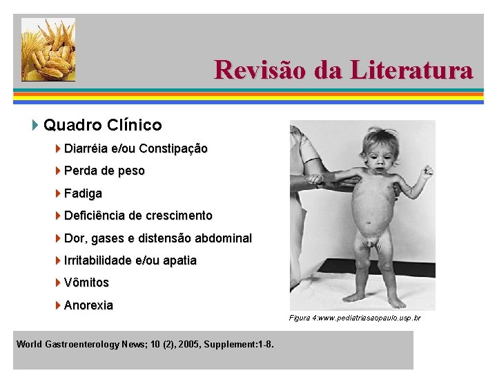 Revisão da Literatura 4 Quadro Clínico 4 Diarréia e/ou Constipação 4 Perda de peso