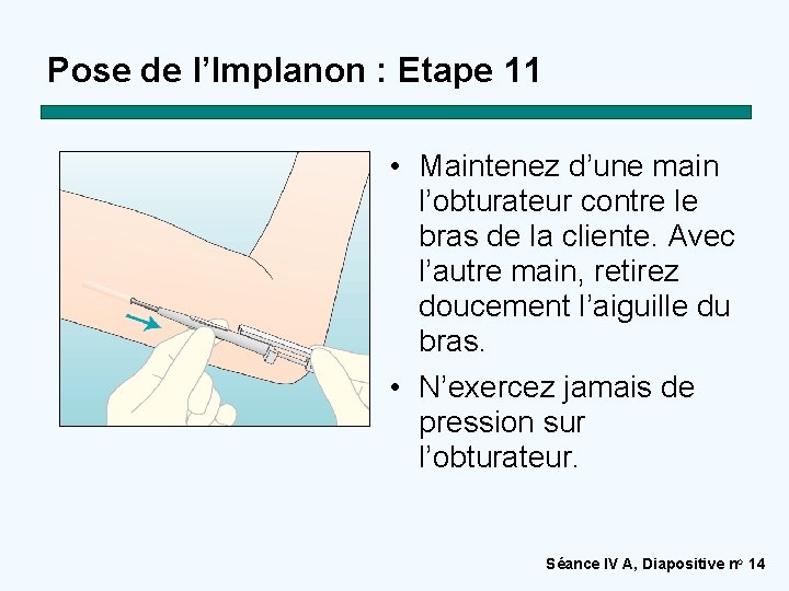 Pose de l’Implanon : Etape 11 • Maintenez d’une main l’obturateur contre le bras