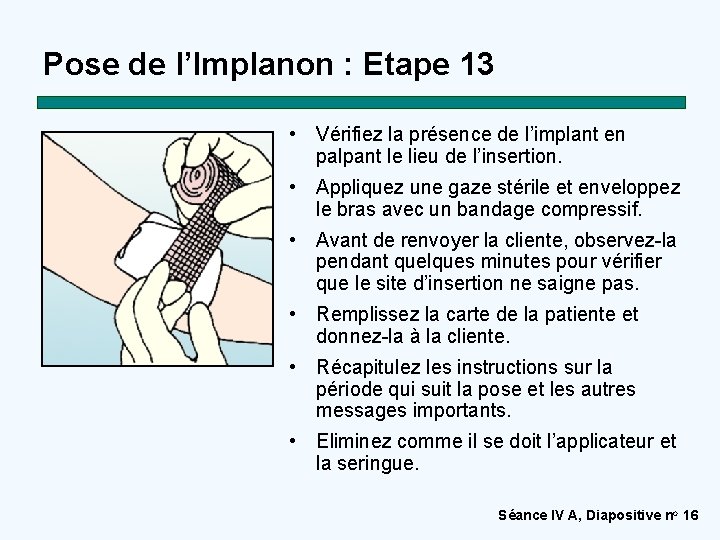 Pose de l’Implanon : Etape 13 • Vérifiez la présence de l’implant en palpant