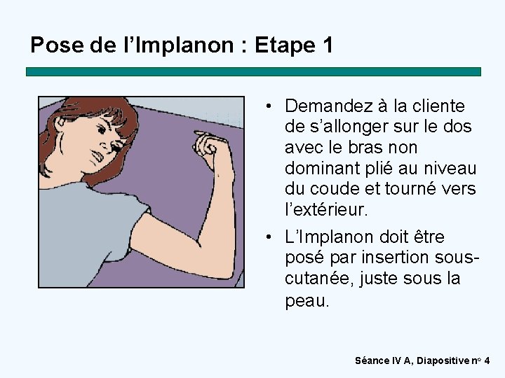 Pose de l’Implanon : Etape 1 • Demandez à la cliente de s’allonger sur