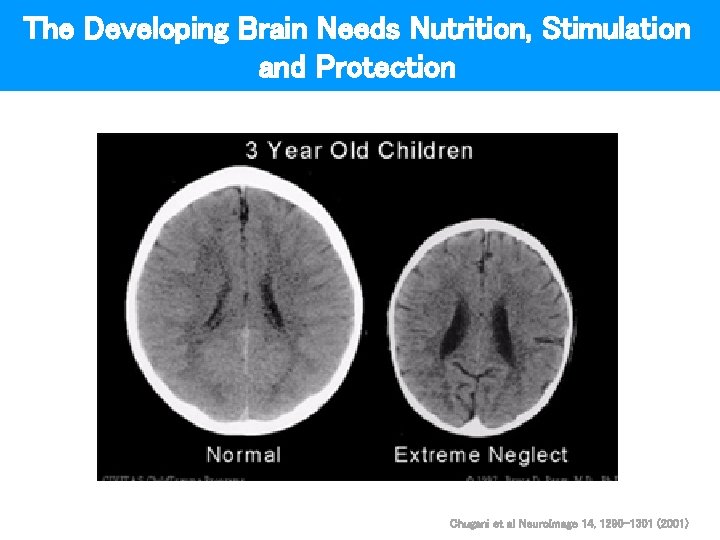 The Developing Brain Needs Nutrition, Stimulation and Protection Chugani et al Neuro. Image 14,