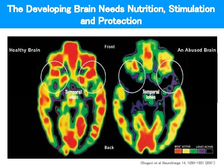 The Developing Brain Needs Nutrition, Stimulation and Protection Chugani et al Neuro. Image 14,