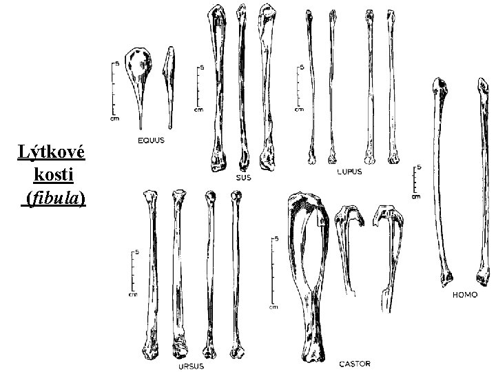 Lýtkové kosti (fibula) 