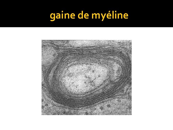  gaine de myéline 