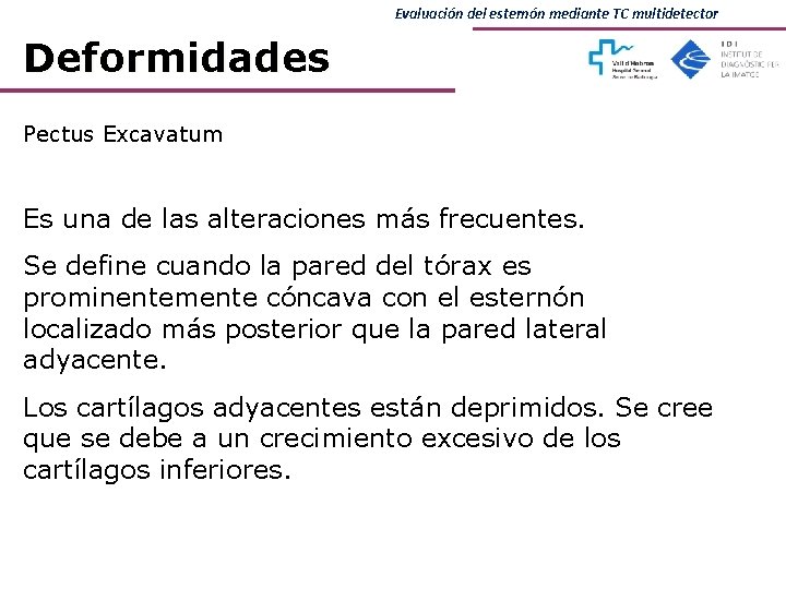 Evaluación del esternón mediante TC multidetector Deformidades Pectus Excavatum Es una de las alteraciones