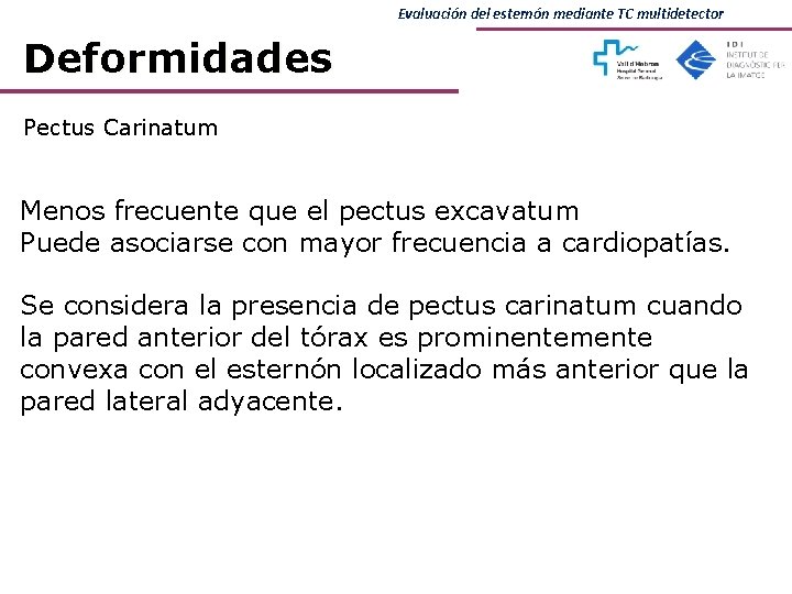 Evaluación del esternón mediante TC multidetector Deformidades Pectus Carinatum Menos frecuente que el pectus