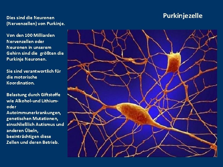 Dies sind die Neuronen (Nervenzellen) von Purkinje. Von den 100 Milliarden Nervenzellen oder Neuronen