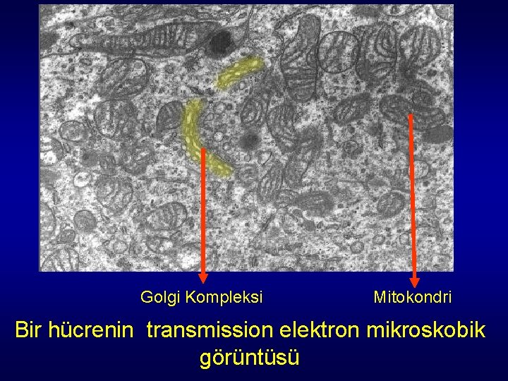Golgi Kompleksi Mitokondri Bir hücrenin transmission elektron mikroskobik görüntüsü Golgi Kompleksi Mitokondri Bir hücrenin transmission elektron mikroskobik görüntüsü