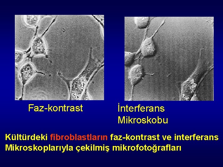 Faz-kontrast İnterferans Mikroskobu Kültürdeki fibroblastların faz-kontrast ve interferans Mikroskoplarıyla çekilmiş mikrofotoğrafları Faz-kontrast İnterferans Mikroskobu Kültürdeki fibroblastların faz-kontrast ve interferans Mikroskoplarıyla çekilmiş mikrofotoğrafları