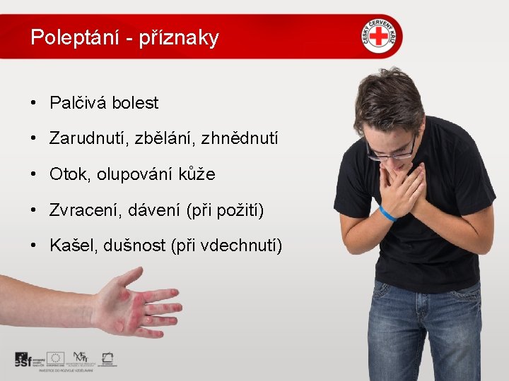 Poleptání - příznaky • Palčivá bolest • Zarudnutí, zbělání, zhnědnutí • Otok, olupování kůže