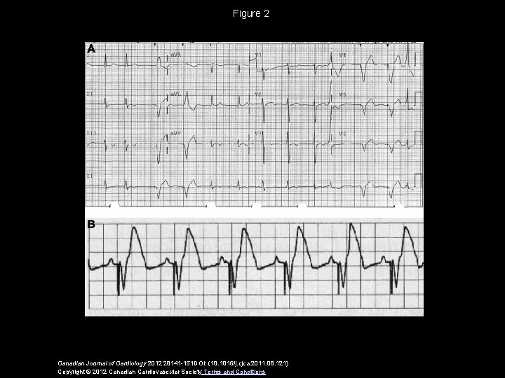 Figure 2 Canadian Journal of Cardiology 2012 28141 -151 DOI: (10. 1016/j. cjca. 2011.