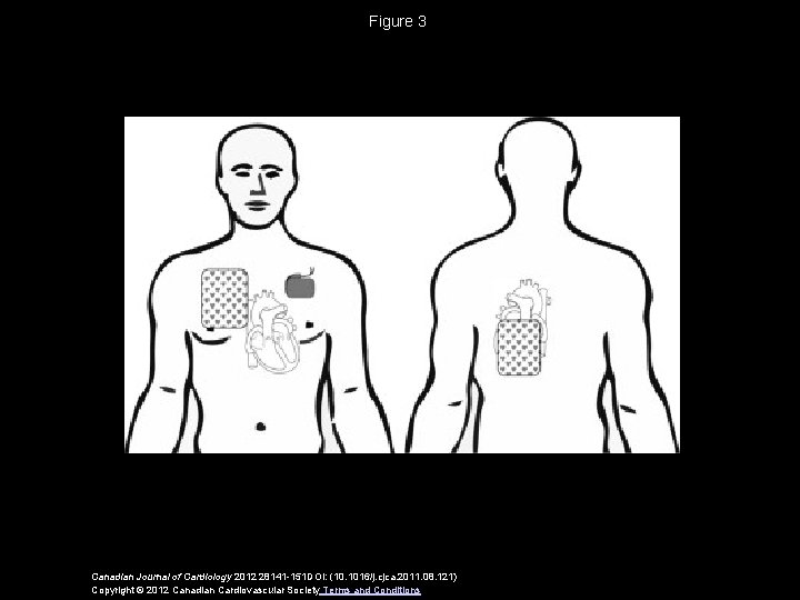 Figure 3 Canadian Journal of Cardiology 2012 28141 -151 DOI: (10. 1016/j. cjca. 2011.