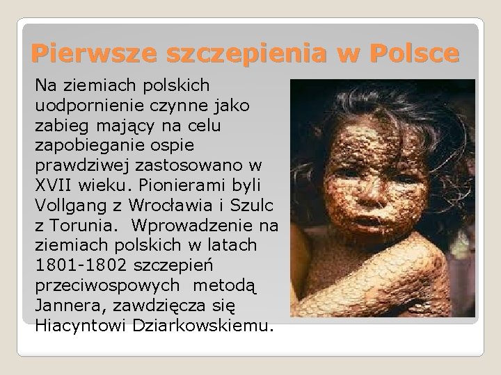 Pierwsze szczepienia w Polsce Na ziemiach polskich uodpornienie czynne jako zabieg mający na celu