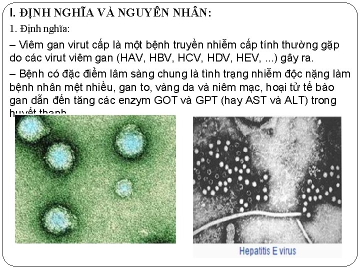 I. ĐỊNH NGHĨA VÀ NGUYÊN NH N: 1. Định nghĩa: ‒ Viêm gan virut