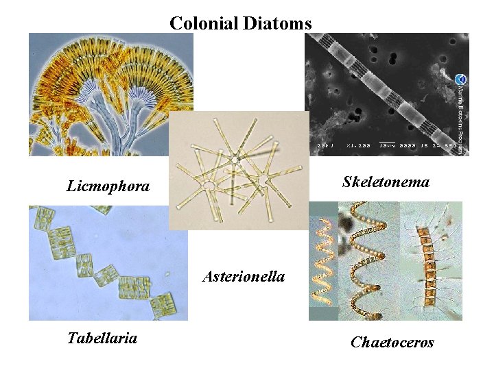 Colonial Diatoms Skeletonema Licmophora Asterionella Tabellaria Chaetoceros 