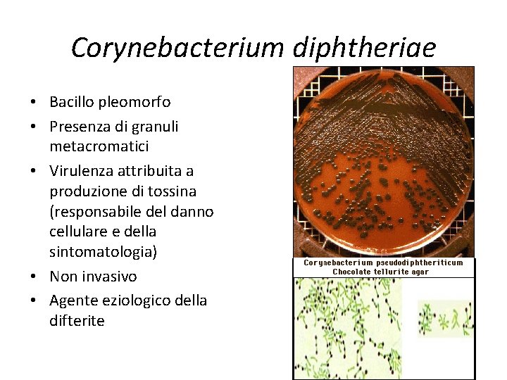 Corynebacterium diphtheriae • Bacillo pleomorfo • Presenza di granuli metacromatici • Virulenza attribuita a