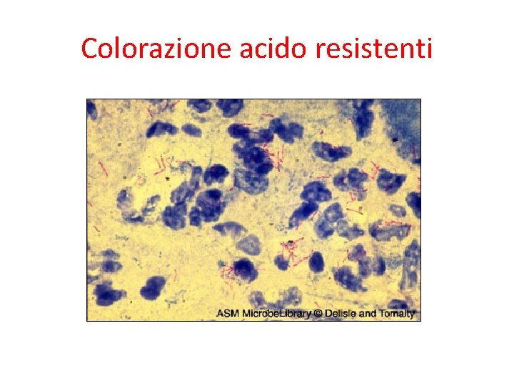 Colorazione acido resistenti 