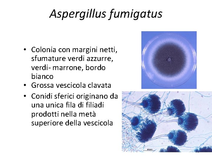 Aspergillus fumigatus • Colonia con margini netti, sfumature verdi azzurre, verdi- marrone, bordo bianco