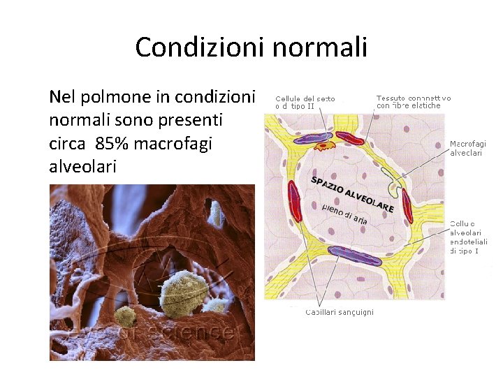 Condizioni normali Nel polmone in condizioni normali sono presenti circa 85% macrofagi alveolari 