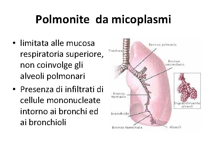 Polmonite da micoplasmi • limitata alle mucosa respiratoria superiore, non coinvolge gli alveoli polmonari Polmonite da micoplasmi • limitata alle mucosa respiratoria superiore, non coinvolge gli alveoli polmonari