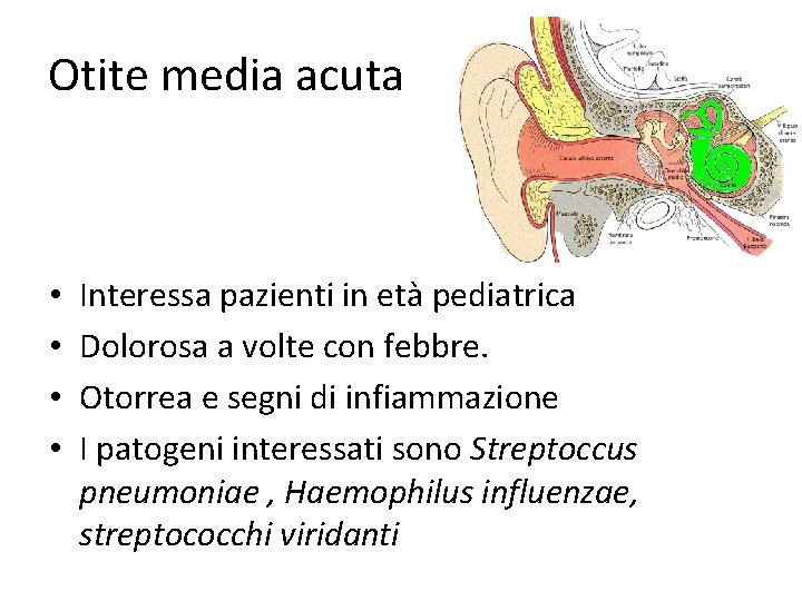 Otite media acuta • • Interessa pazienti in età pediatrica Dolorosa a volte con