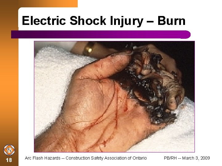 Electric Shock Injury – Burn 18 Arc Flash Hazards -- Construction Safety Association of