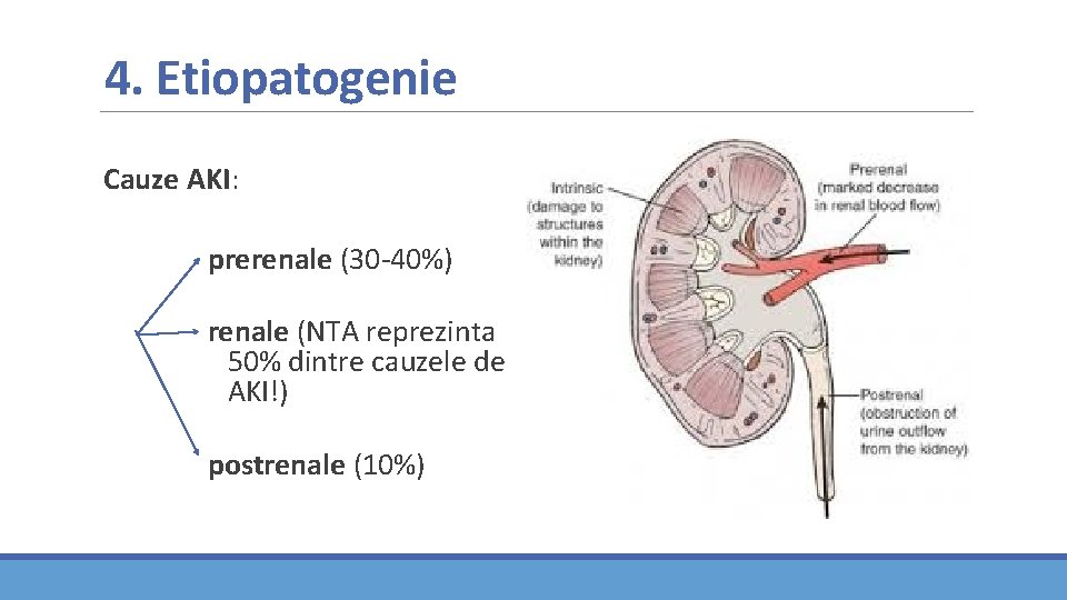 4. Etiopatogenie Cauze AKI: prerenale (30 -40%) renale (NTA reprezinta 50% dintre cauzele de 4. Etiopatogenie Cauze AKI: prerenale (30 -40%) renale (NTA reprezinta 50% dintre cauzele de