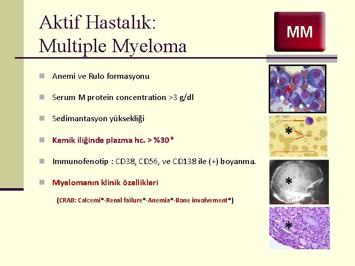 Aktif Hastalık: Multiple Myeloma MM n Anemi ve Rulo formasyonu n Serum M protein