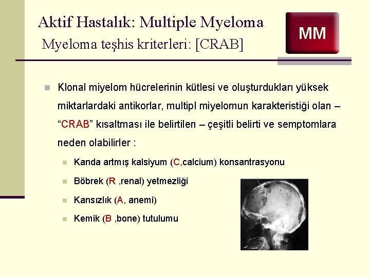 Aktif Hastalık: Multiple Myeloma teşhis kriterleri: [CRAB] MM n Klonal miyelom hücrelerinin kütlesi ve