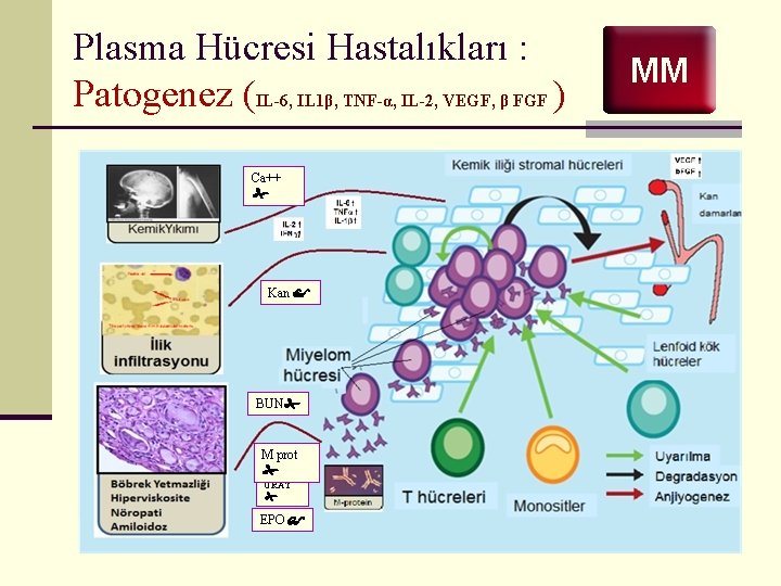 Plasma Hücresi Hastalıkları : Patogenez (IL-6, IL 1β, TNF-α, IL-2, VEGF, β FGF )