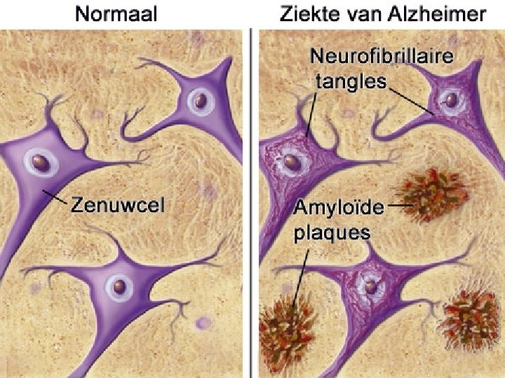 Zorgvragers met dementie Hoofdstuk 5 2 