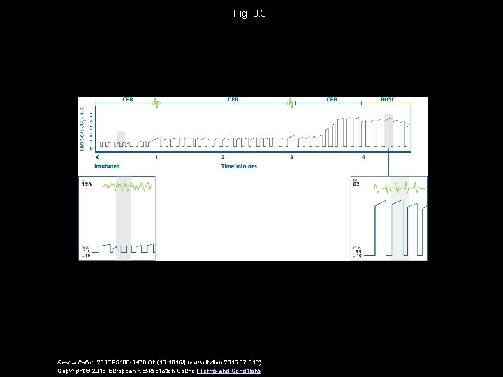 Fig. 3. 3 Resuscitation 2015 95100 -147 DOI: (10. 1016/j. resuscitation. 2015. 07. 016)