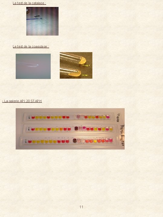  • Le test de la catalase : • Le test de la coagulase