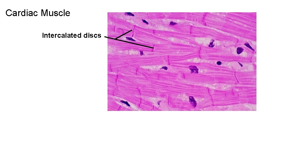 Cardiac Muscle Intercalated discs 