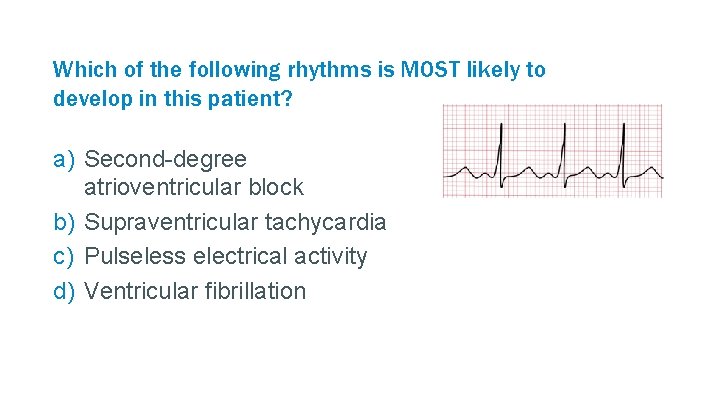 Which of the following rhythms is MOST likely to develop in this patient? a)