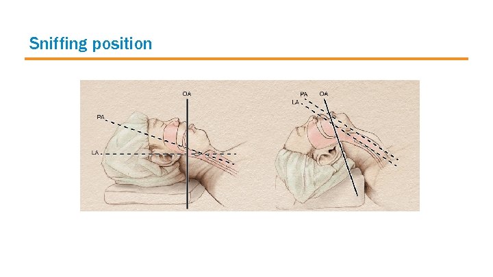 Sniffing position 