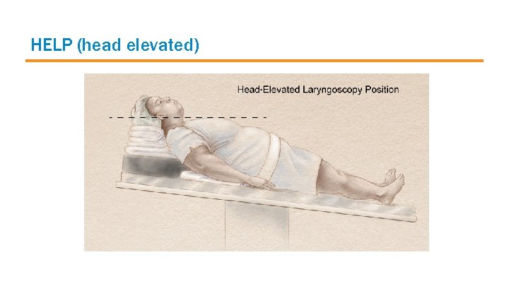 HELP (head elevated) 