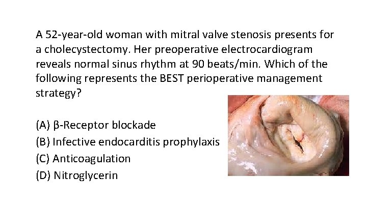 A 52 -year-old woman with mitral valve stenosis presents for a cholecystectomy. Her preoperative