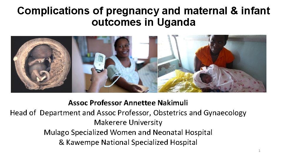 Complications of pregnancy and maternal & infant outcomes in Uganda Assoc Professor Annettee Nakimuli