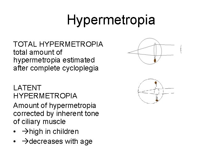 hyperopia kezelés 3